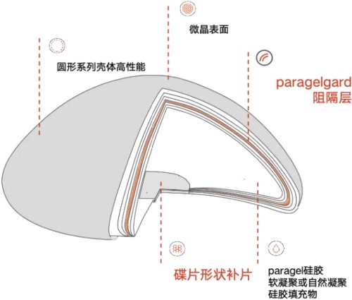 2025优丝俪高奢隆胸价格表，含曼妙系列/优雅系列/蜜桃系列收费标准+特色