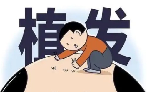 急问：斑秃可以植发治疗吗？术后还会不会脱发呢？