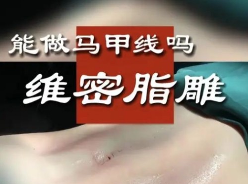 维密脂雕和水动力吸脂区别是什么？哪个好？技术原理、维持时间、适应人群来看