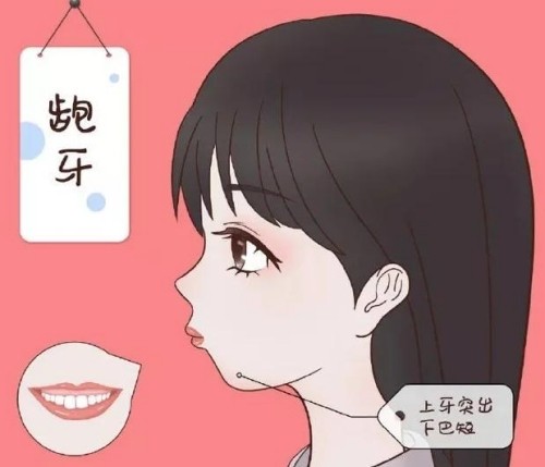 牙齿整齐但是嘴巴前凸怎么矫正？骨性/牙性矫正方式各不同，附收费价格