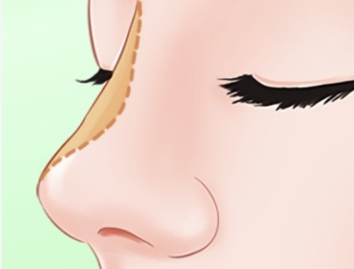 西安整形医生刘学龙怎么样？眼鼻整形、吸脂塑形技术都不错