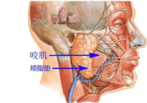 去颊脂垫价格及恢复时间公布，颊脂垫去除后脸部凹陷塌了正常吗？