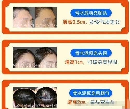 韩国做医美可以退税吗？赴韩整形美容口碑好的医院有哪些？