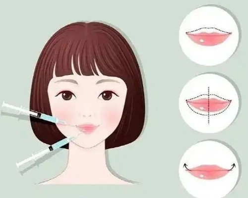 玻尿酸丰唇打几支维持更久？嘟嘟唇打什么牌子玻尿酸好？