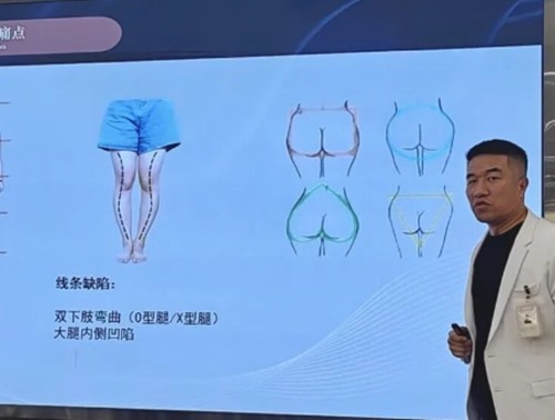 北京全身抽脂手术价格及名医介绍，王东、王阳、冯斌吸脂修复评分高