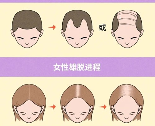 南阳治疗脱发哪家医院好一些？维多利亚、仁康种植发际线养发均可靠