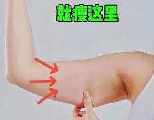手臂打溶脂针效果好吗？一般需要多少钱？