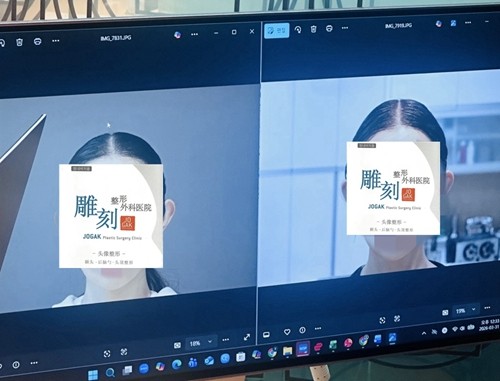 高顱頂美人的標準是什麼？從視覺比例到骨相架構，揭祕韓國雕刻的自然增高術