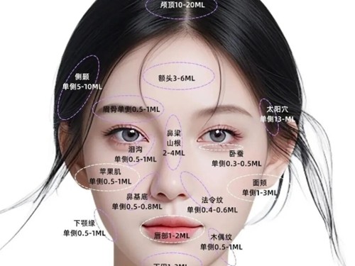 佛山玻尿酸注射口碑医生分享，杨镁施、彭永东玻尿酸塑形抗衰实力在线
