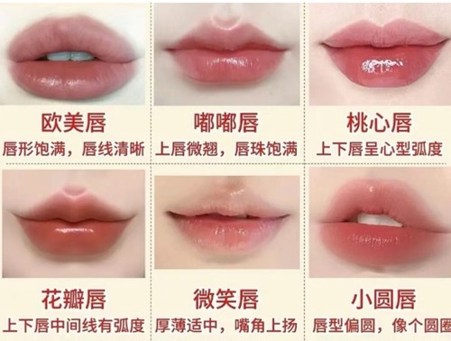 广州唇部整形做的好的医生介绍，刘美娇、张小芸注射丰唇技术及审美在线