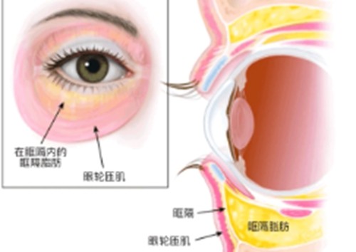 长治眼袋手术多少钱？全新眼袋整形价格及性价比高的整形医院一览