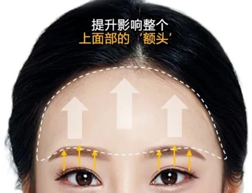 韩国额头提拉手术好的医院分享，Yourtime、梦想、德蔓特额头提升人气火爆