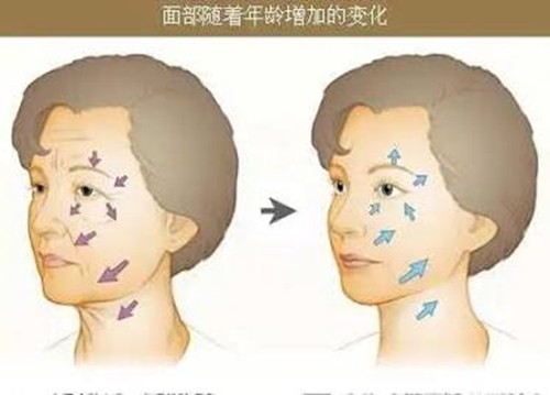 成都做面部年轻化好评的医生介绍，江颖、杨箐箐除皱抗衰技术审美均不错