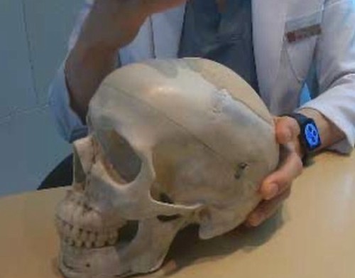 额头比较短能做填充吗？一文看懂额头整形如何打造饱满立体感