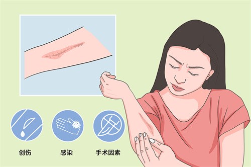 上海九院疤痕修复医生排名+除疤价格新发布，网评武晓莉祛疤3w不坑