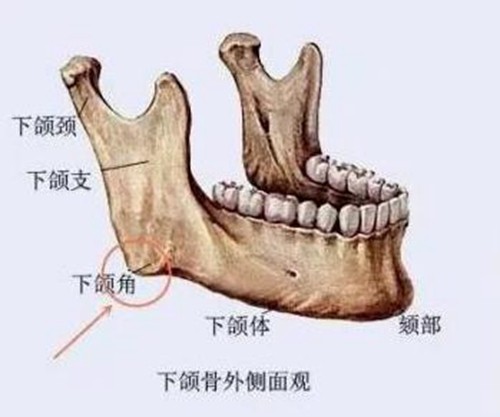 下颌角截骨手术怎么做的,切口多大？下颌角削骨改脸型属于高风险手术吗？