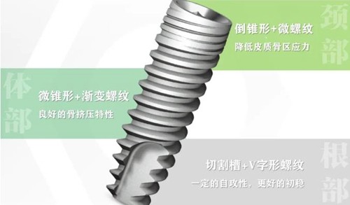 2025abt种植体价格表一览，德国进口SPI6k/DFI8k/Arrow窄款9.8k/全口12w+