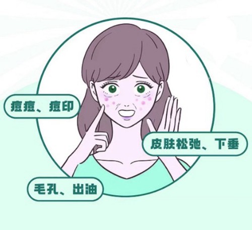 韩国黄金微针多少钱一次，哪家皮肤科医院做的好？