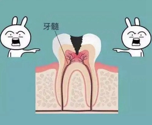 周口正规医院根管治疗收费标准来袭，含根管治疗好的牙科诊所名单