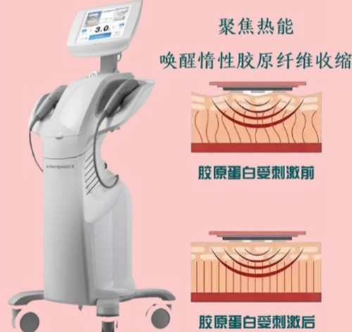 揭秘：做7D聚拉提之后会加速变老吗，整形医生不建议做7D聚拉提的原因是什么？