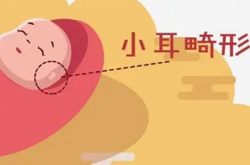 内窥镜耳部再造术好不好，价格是多少？中韩哪家医院做内窥镜耳部再造术好
