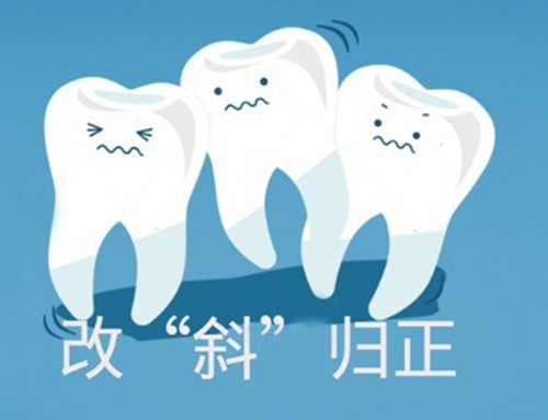 桐乡牙齿矫正哪家医院好？排名前五的松丰/微笑/杭雅儿童正畸&成人矫正均不错