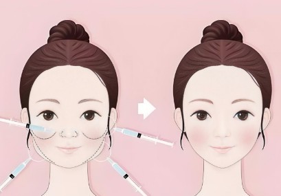 馒化脸修复三次还能救回来吗？蒋铮铮&朱慧东：审美在线技术牛，轻松还您自然脸庞
