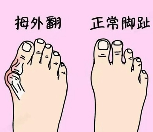 苏敬达和马桂文做大脚骨手术哪个技术更好，做足部整形价格是多少？
