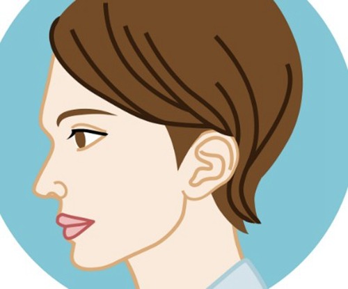 卢建3D-PEEK定制下巴深度评测：费用明细、技术逻辑与结构化美学优势