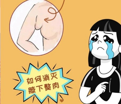 国内做副乳切除手术全攻略：2026价格行情、医院选择及术后恢复指南