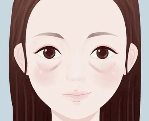 钻石超塑和热拉提哪个会更好,眼周细纹多显老做几次合适？