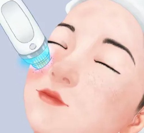 揭晓韩国做黄金微针除皱多少钱，韩首尔五大热门皮肤科核心技术特色