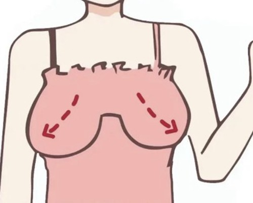 乳房维维提升手术的弊端和优势是什么，找李建东做胸部提升好约吗？