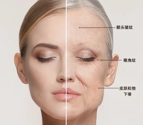 刘远程无痕筋膜提升好还是李建钢好？来看核心术式、剥离防线与美学风格