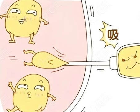 韓國腰腹吸脂手術多少錢？看2026韩国​夢想、德蔓特、365mc技術特色和預算