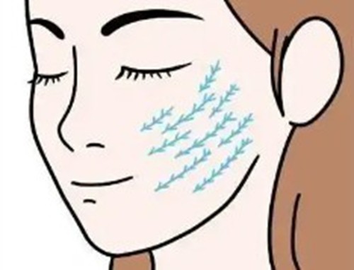 做拉皮手術後還可以再進行微調嗎？​首爾五大名院術後二次維養與複合抗衰指南