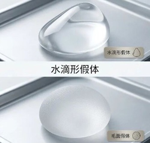 假体隆胸多久变得和真胸一样柔软？普罗菲耳/FAURE隆胸术后手感演变周期分享