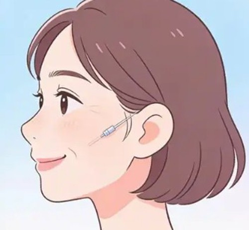 成都美莱玻尿酸注射哪个医生好？热门名医特色及2026费用指南
