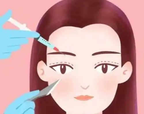 濡白天使打眉弓好还是少女针好？再生材料骨相微雕的深度选材指南