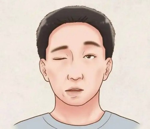 韩国眼提肌无力手术怎么选？梦想、爱护、Yourtime、德蔓特四强医院​技术解析