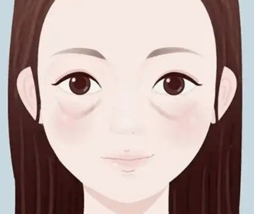 谭琳琳眼周赋活抗衰是打玻尿酸吗？解析眼部年轻化的多维科技与选材真相