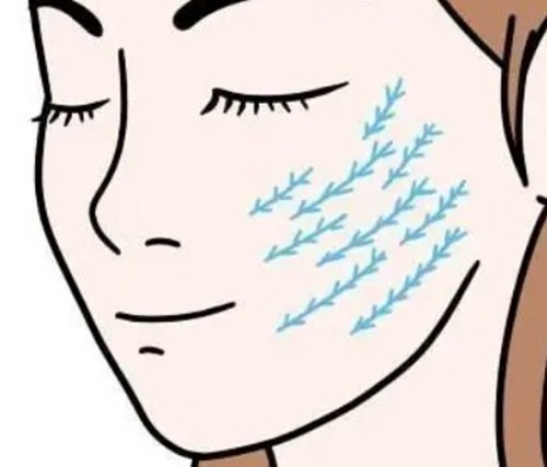 王春虎苹果肌悬吊手术减龄明显吗？拆解面部中轴线抗衰技术原理与术后表现