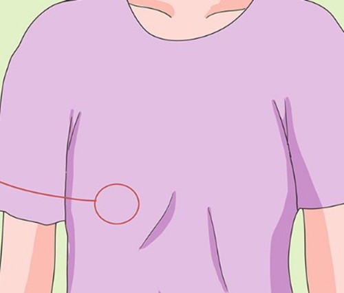 乳晕缩小术后会有褶皱吗？韩国普罗菲耳与Faure美学理念对比深度测评