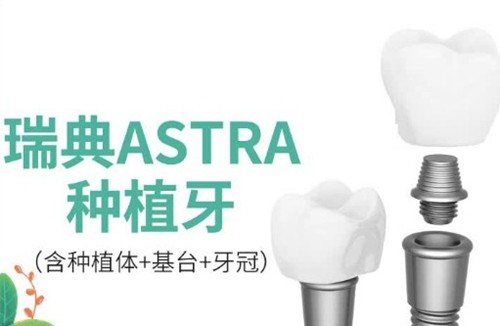 瑞典Astra种植体型号及规格全盘点：2026年收费价格与选择指南