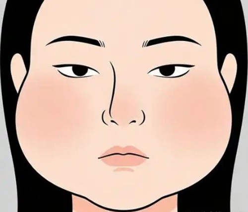 杭州裴晶晶面部减容三件套改善馒化脸有用吗？错位组合提升做完面部自然灵动