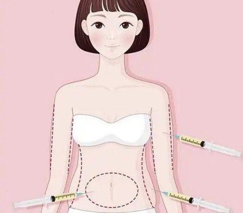 深圳爱贝芙注射好的医生攻略：黄海龙、黄俊超、邓璐雯技术与2026真实收费