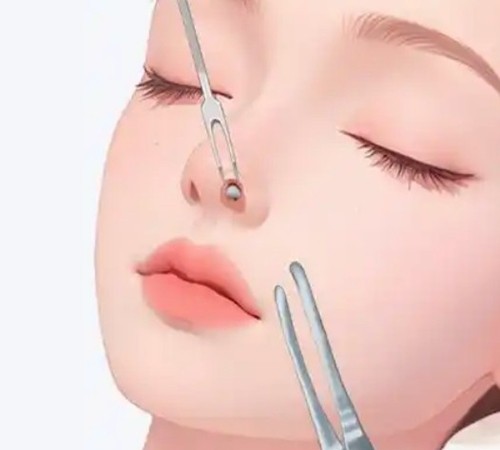 卿勇鼻畸形矫正做的好吗？注重鼻部与面部的整体协调性高难度修复也nice