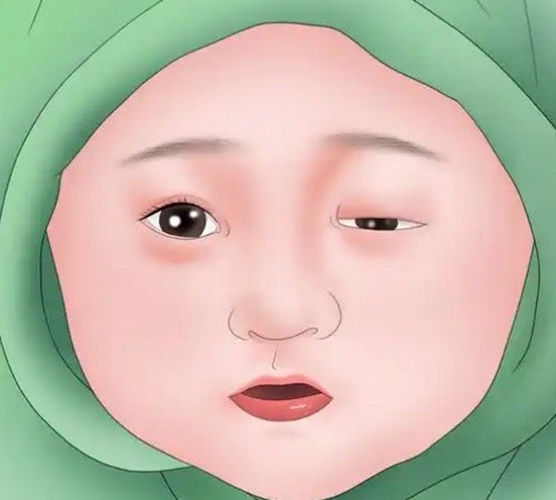 上眼睑下垂北京哪个医生做手术好？网友力荐top10修复名医技术与特色揭秘