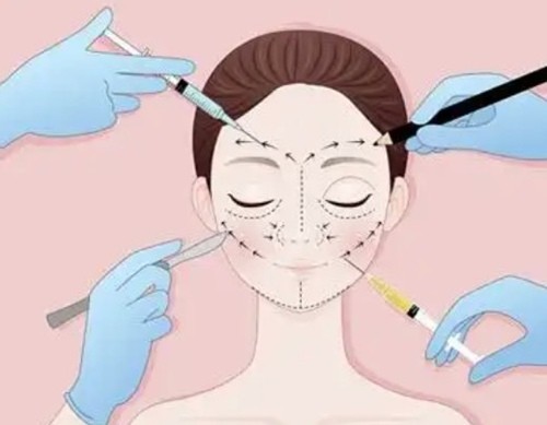 广州朱志娟三维灌注提升在哪坐诊？坐诊曙光液态锚定分层收紧做完脸轻薄紧致