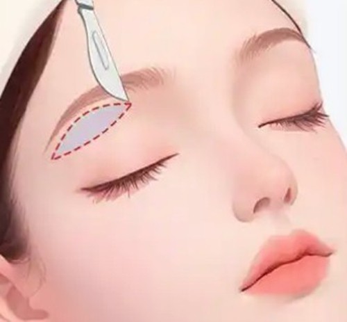 做提眉手术重庆哪位医生技术好？看6位口碑技术俱佳的医生特色与价格